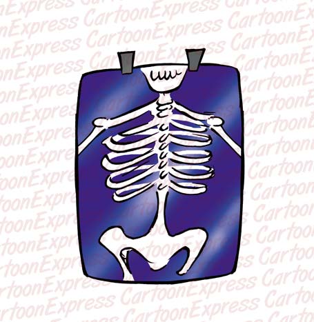 x-ray